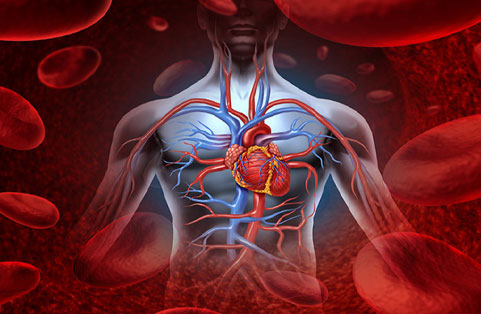 Coronary Artery Disease